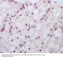 Anti-MAD2L1BP/Mad2L1 Binding Protein Rabbit Monoclonal Antibody