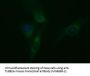 Anti-beta II Tubulin (TUBB2A) Mouse Monoclonal Antibody [Clone ID: OTI3E6]