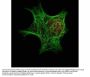 Anti-Keratin KRT6C Monoclonal Antibody