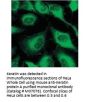 Anti-Keratin KRT6C Monoclonal Antibody
