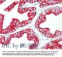 Anti-Keratin KRT6C Monoclonal Antibody