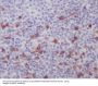 Anti-Integrin alpha E ITGAE Rabbit Monoclonal Antibody