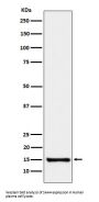 Anti-SAA4 Rabbit Monoclonal Antibody