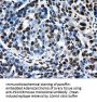 Anti-PSMC3 Mouse Monoclonal Antibody [Clone ID: OTI9F3]