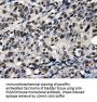 Anti-PSMC3 Mouse Monoclonal Antibody [Clone ID: OTI9F3]
