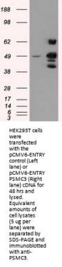 Anti-PSMC3 Mouse Monoclonal Antibody [Clone ID: OTI9F3]
