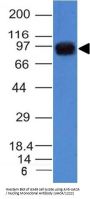 Anti-UACA / Nucling (Nuclear Membrane Marker) Monoclonal Antibody