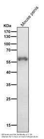 Anti-Cytokeratin 4 KRT4 Rabbit Monoclonal Antibody