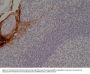 Anti-Cytokeratin 4 (CK-4) Rabbit Monoclonal Antibody, Clone#RM355