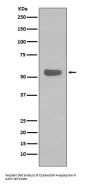 Anti-Cytokeratin 4 KRT4 Rabbit Monoclonal Antibody
