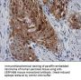 Anti-SERPINB4 Mouse Monoclonal Antibody [Clone ID: OTI4C8]