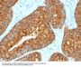 Anti-MAML3 (Mastermind Like Transcriptional Coactivator 3) Monoclonal Antibody