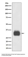 Anti-Mast Cell Tryptase Rabbit Monoclonal Antibody