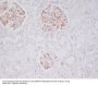 Anti-Mast Cell Tryptase Rabbit Monoclonal Antibody
