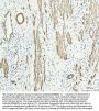 Anti-Calponin CNN1 Rabbit Monoclonal Antibody