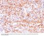 Anti-Calponin-1 (Smooth Muscle Marker) Monoclonal Antibody