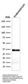 Anti-Calponin-1 (Smooth Muscle Marker) Monoclonal Antibody