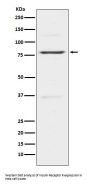 Anti-Insulin Receptor R INSRR Monoclonal Antibody