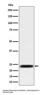 Anti-ARFRP1 / ARP Rabbit Monoclonal Antibody