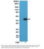 Anti-Acetyl-alpha-Tubulin (Lys40) TUBA1B Rabbit Monoclonal Antibody, Clone#RM318