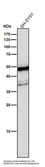 Anti-beta II Tubulin Rabbit Monoclonal Antibody