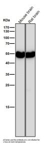 Anti-beta II Tubulin Rabbit Monoclonal Antibody