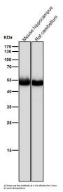 Anti-beta II Tubulin Rabbit Monoclonal Antibody