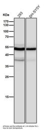 Anti-beta II Tubulin Rabbit Monoclonal Antibody