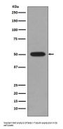 Anti-beta II Tubulin Rabbit Monoclonal Antibody
