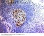 Anti-CD57 / B3GAT1 (Natural Killer Cell Marker) Monoclonal Antibody