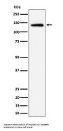 Anti-Importin 9 / RANBP9 Rabbit Monoclonal Antibody