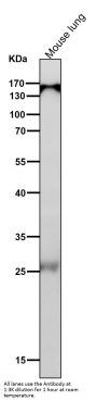 Anti-Importin 9 / RANBP9 Rabbit Monoclonal Antibody