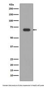 Anti-Alas1/Alas H Rabbit Monoclonal Antibody