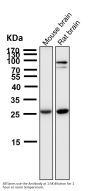 Anti-SCGN Monoclonal Antibody