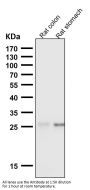 Anti-SCGN Monoclonal Antibody