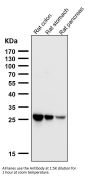 Anti-SCGN Monoclonal Antibody