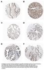 Anti-PIDD PIDD1 Antibody (Monoclonal, Anto-1)