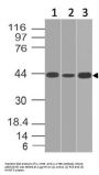 Anti-IL-17RE Antibody (Monoclonal, ABM2G70)