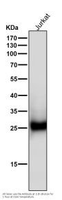 Anti-ZNRF2 Rabbit Monoclonal Antibody