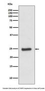 Anti-ZNRF2 Rabbit Monoclonal Antibody