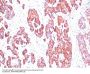Anti-Cytokeratin, Basic (Type II or HMW) (Epithelial Marker) Monoclonal Antibody