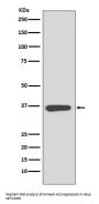 Anti-Annexin A10 Rabbit Monoclonal Antibody