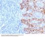 Anti-Cytokeratin, Acidic (Type I or LMW) (Epithelial Marker) Monoclonal Antibody