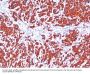 Anti-Cytokeratin, pan (Epithelial Marker) Monoclonal Antibody