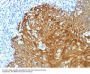 Anti-Cytokeratin, pan (Epithelial Marker) Antibody