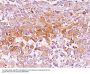 Anti-gp100 / Melanosome / PMEL17 / SILV (Melanoma Marker) Monoclonal Antibody