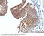 Anti-Cytokeratin 6 (KRT6) (Hyperproliferation-Related Keratin) Monoclonal Antibody