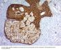 Anti-Cytokeratin, pan (Epithelial Marker) Antibody