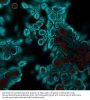 Anti-Cytokeratin, pan (Epithelial Marker) Antibody
