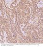 Anti-EpCAM/Trop1 Rabbit Monoclonal Antibody